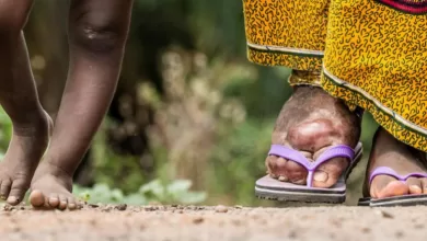 big mG40tKqoFgzzuxX4nYWbiXRsY