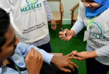 measles