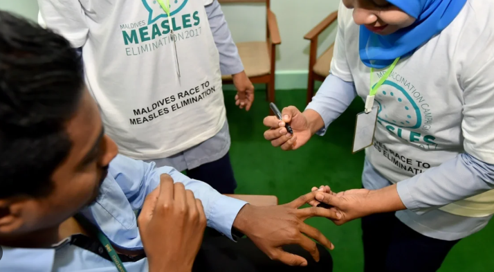 measles