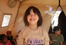 hiba downsyndrom