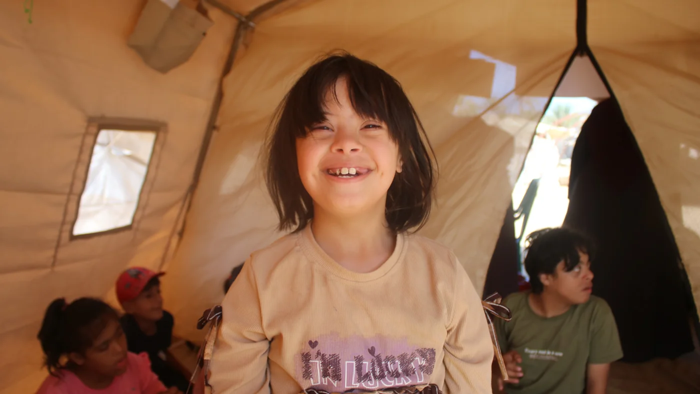 hiba downsyndrom