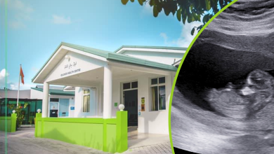 Velidhoo Sihhee marukazu Ultra Sound Scan